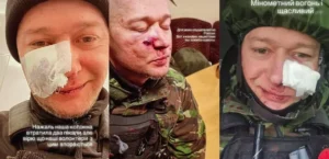 Подробнее о статье Бумбокс розповів про перше поранення в бою