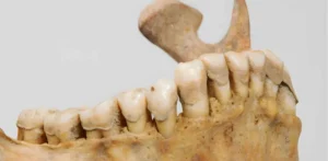 Подробнее о статье Сліди психоактивних речовин у зубах жінки з бронзової доби