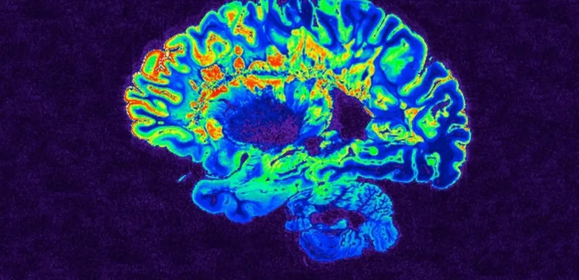 Подробнее о статье Нові відкриття у дослідженні розсіяного склерозу
