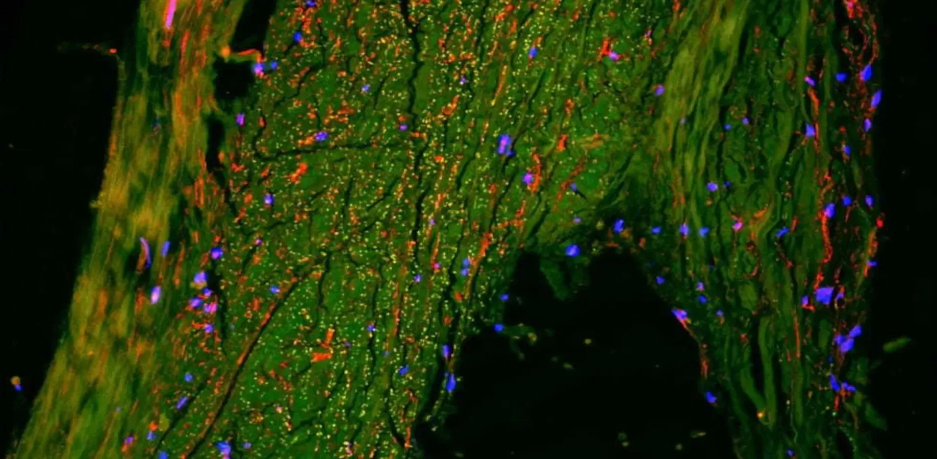 Подробнее о статье Нові відкриття в дослідженні хвороби Альцгеймера